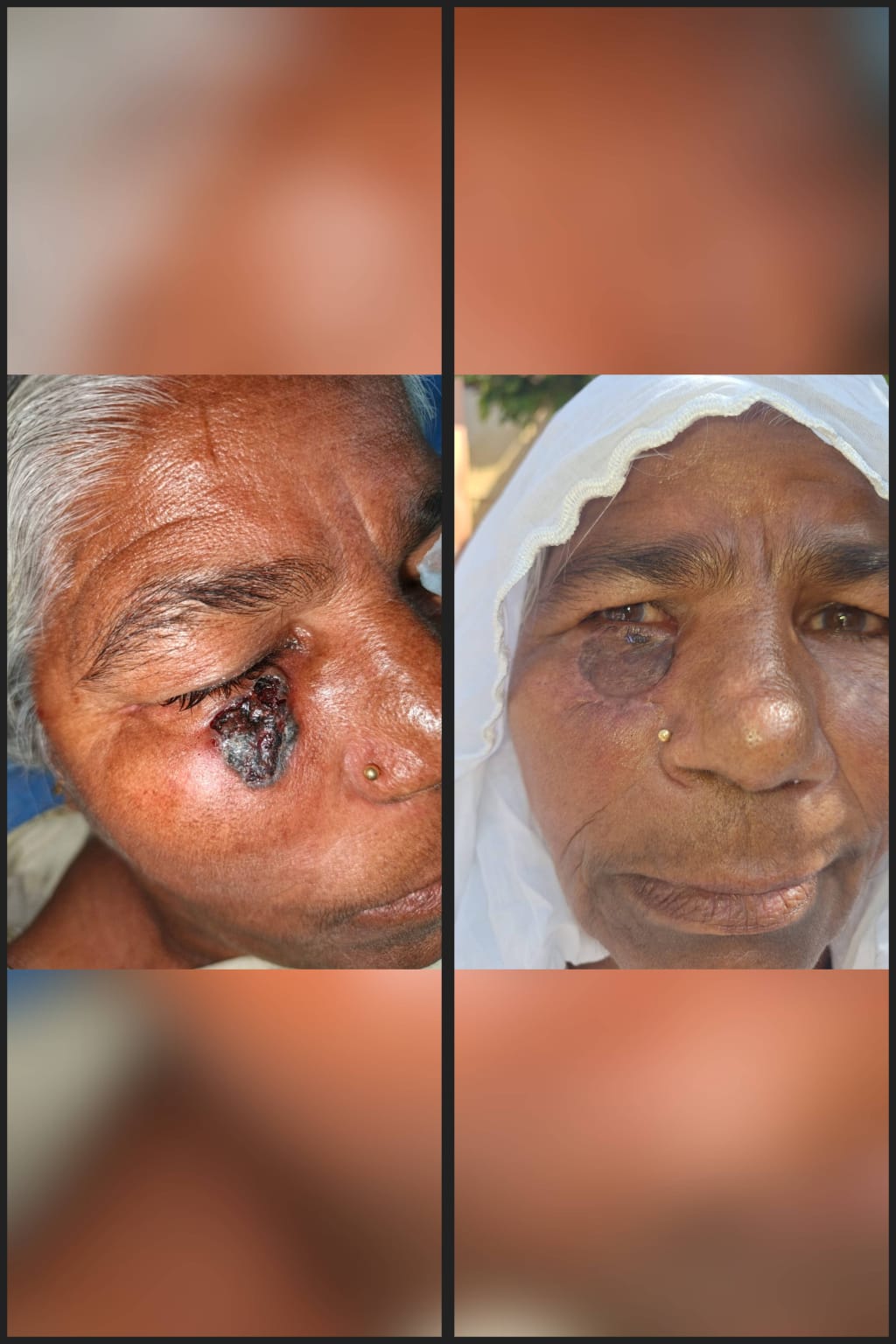Before & After 7